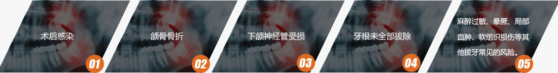 深圳拔牙多少钱